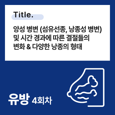 양성 병변 (섬유선종, 낭종성 병변) 및 시간 경과에 따른 결절들의 변화 & 다양한 낭종의 형태